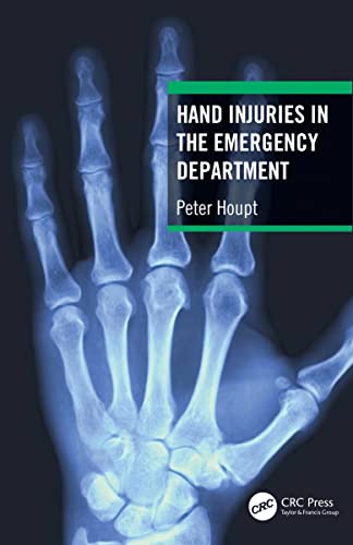 Hand Injuries In The Emergency Department 1st Edition Peter Houpt