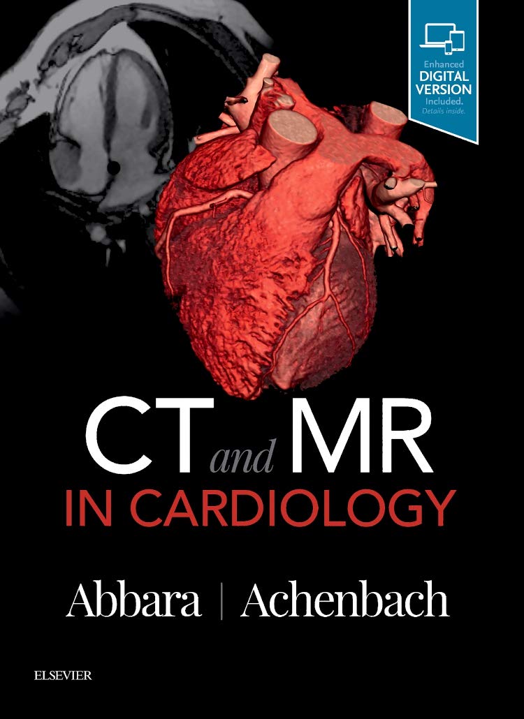 Ct And Mr In Cardiology 1st Edition Suhny Abbara Stephan Achenbach