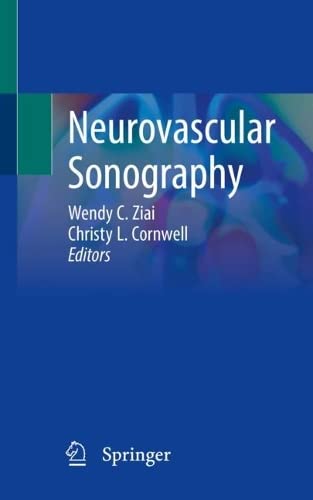 Neurovascular Sonography Wendy C Ziai Christy L Cornwell