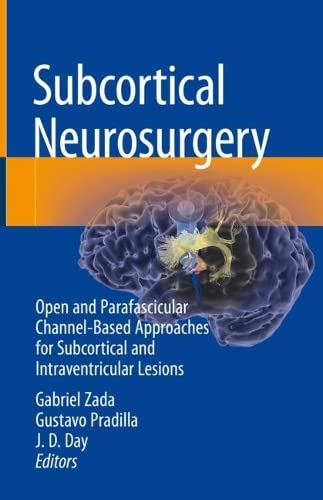 Subcortical Neurosurgery Open And Parafascicular Channelbased Approaches For Subcortical And Intraventricular Lesions Gabriel Zada