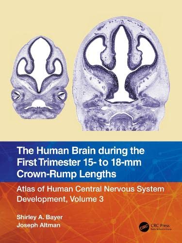 The Human Brain During The First Trimester 15 To 18mm Crownrump Lengths Atlas Of Human Central Nervous System Development Volume 3 Shirley A Bayer