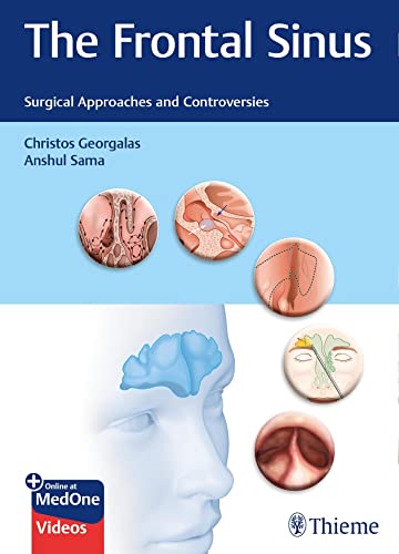 The Frontal Sinus Surgical Approaches And Controversies Christos Georgalas
