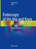 Endoscopy Of The Hip And Knee Principle And Practice 1st Tun Hing Lui