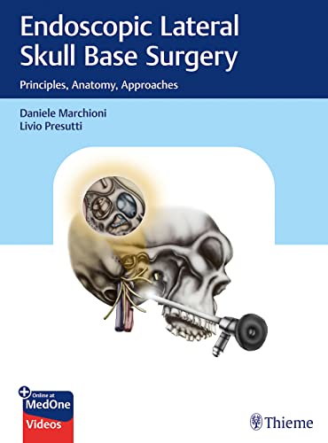 Endoscopic Lateral Skull Base Surgery Principles Anatomy Approaches Daniele Marchioni