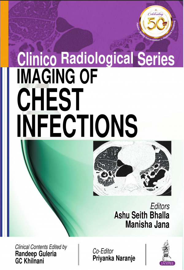 Clinico Radiological Series Imaging Of Chest Infections Nov 30 20189352705025 Ashu Seith Bhalla