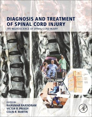 Diagnosis And Treatment Of Spinal Cord Injury 1st Edition Rajkumar Rajendram