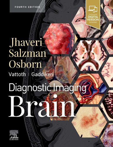 Diagnostic Imaging Brain 4th Miral D Jhaveri Karen L Salzman
