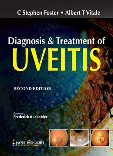 Diagnosis And Treatment Of Uveitis 2nd Edition C Stephen Foster Md Facs