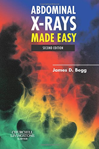 Abdominal Xrays Made Easy 2nd Edition James D Begg Mb Bs Frcr