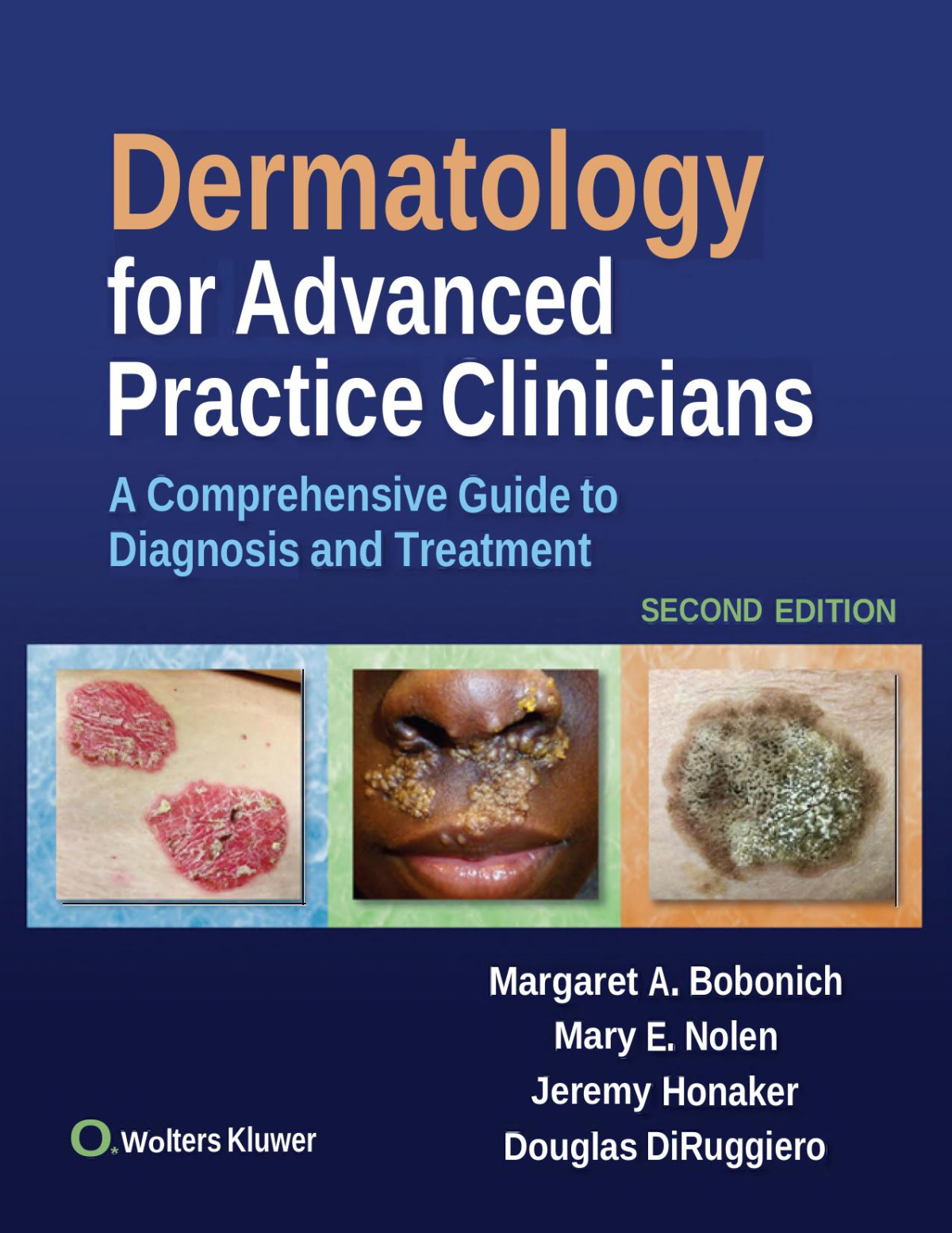 Dermatology For Advanced Practice Clinicians A Practical Approach To Diagnosis And Treatment 2nd Margaret A Bobonich