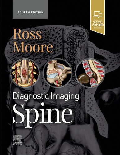 Diagnostic Imaging Spine Jeffrey S Ross Md And Kevin R Moore Md