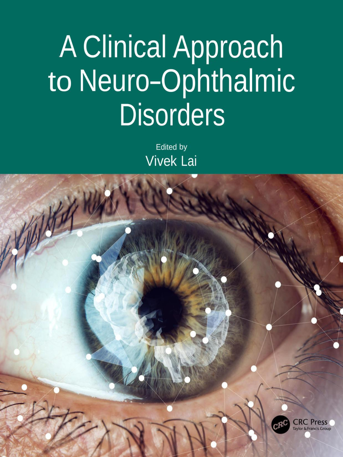 A Clinical Approach To Neuroophthalmic Disorders Vivek Lal