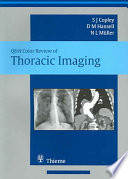 Thoracic Imagingselfassessment Colour Review Illustrated Clinical Cases May 1 20051588903796mansonpdf Sue Copley