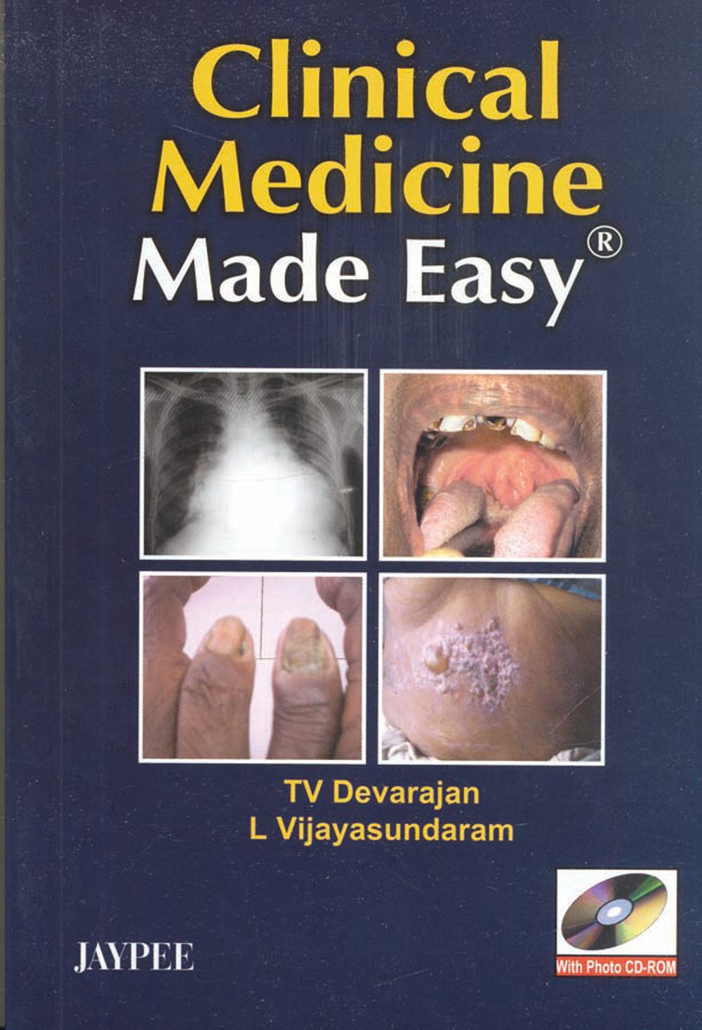 Clinical Medicine Made Easy 1st Edition Tv Devarajan L Vijayasundaram