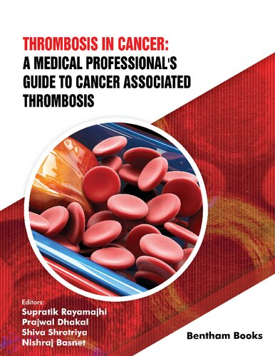 Thrombosis In Cancer A Medical Professionals Guide To Cancer Associated Thrombosis Supratik Rayamajhi