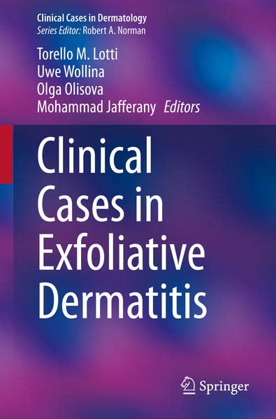 Clinical Cases In Exfoliative Dermatitis Torello M Lotti Uwe Wollina