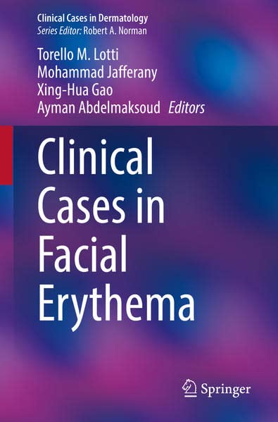 Clinical Cases In Facial Erythema Torello M Lotti Mohammad Jafferany