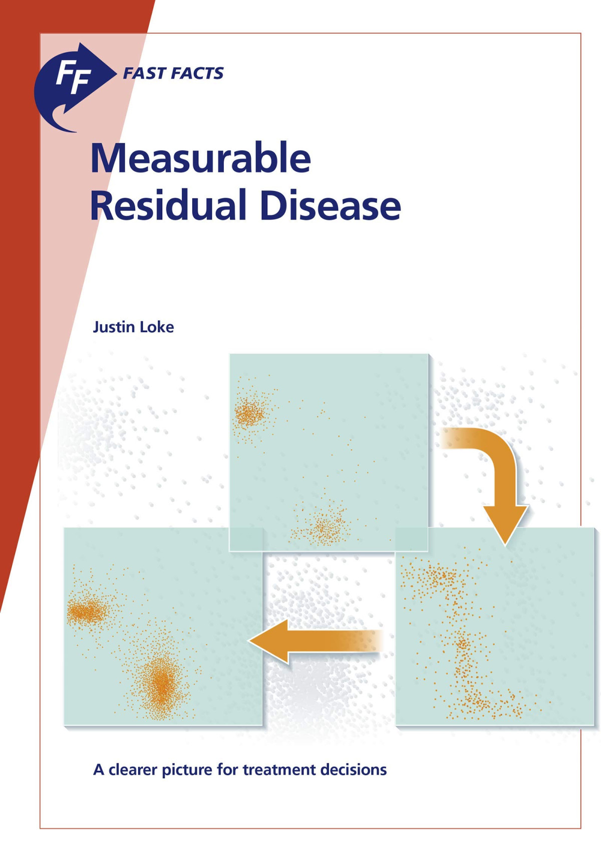 Measurable Residual Disease A Clearer Picture For Treatment Decisions Justin Loke
