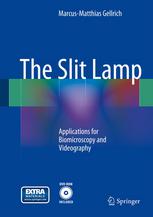 The Slit Lamp Applications For Biomicroscopy And Videography 1st Edition Marcusmatthias Gellrich Auth
