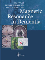 Magnetic Resonance In Dementia 1st Edition Jaap Valk Md Phd Frederik Barkhof Md