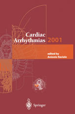 Cardiac Arrhythmias 2001 Proceedings Of The 7th International Workshop On Cardiac Arrhythmias Venice 710 October 2001 1st Edition P M Spooner Auth