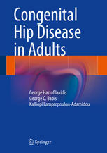 Congenital Hip Disease In Adults 1st Edition George Hartofilakidis