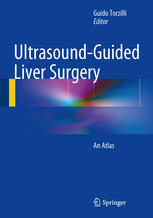 Ultrasoundguided Liver Surgery An Atlas 1st Edition Guido Torzilli
