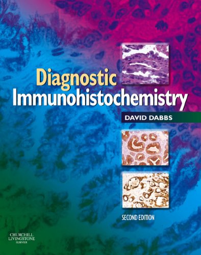 Diagnostic Immunohistochemistry 2nd Edition David J Dabbs Auth
