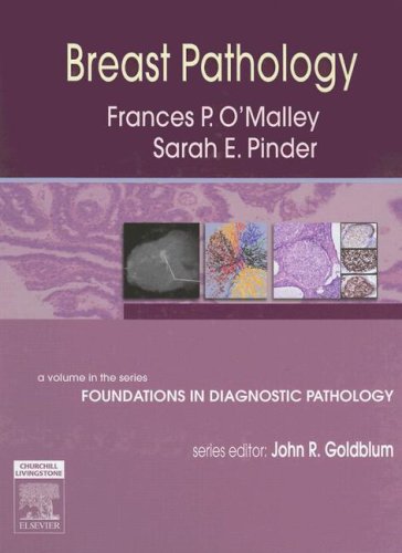Breast Pathology A Volume In Foundations In Diagnostic Pathology Series 1st Frances P Omalley
