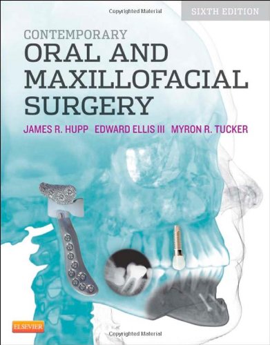 Contemporary Oral And Maxillofacial Surgery 6e 6th Edition James R Hupp