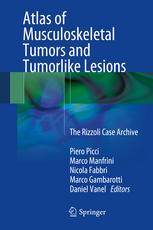 Atlas Of Musculoskeletal Tumors And Tumorlike Lesions The Rizzoli Case Archive 1st Edition Piero Picci Md Auth