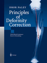 Principles Of Deformity Correction 1st Edition Dror Paley Md