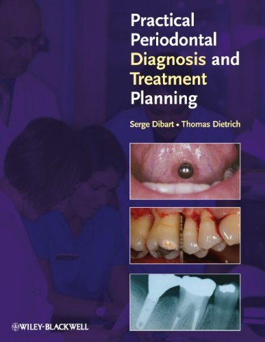 Practical Periodontal Diagnosis And Treatment Planning 1st Edition Serge Dibart