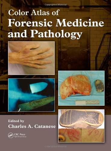 Color Atlas Of Forensic Medicine And Pathology 1st Edition Charles Catanese
