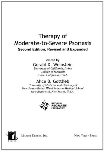 Therapy Of Moderatetoseverepsoriasis Second Edition 2nd Edition Gerald Weinstein