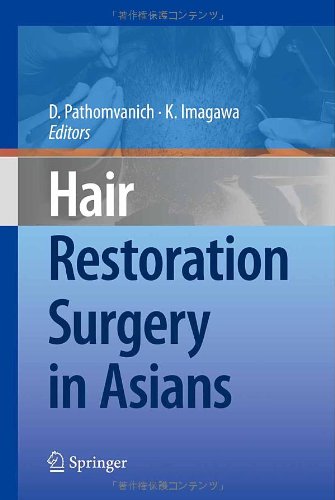 Hair Restoration Surgery In Asians 1st Edition Kenichiro Imagawa Md
