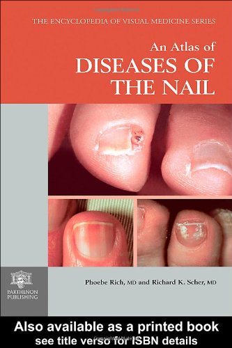 An Atlas Of Diseases Of The Nail Phoebe Rich Richard K Scher