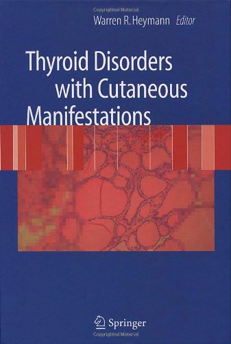 Thyroid Disorders With Cutaneous Manifestations 1st Edition Gabriel Wong Md
