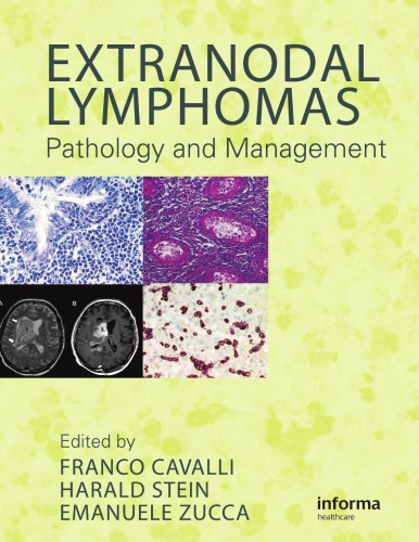 Extranodal Lymphomas Pathology And Management Cavalli Franco
