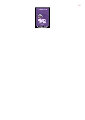 Glaucoma Therapy Current Issues And Controversies Shaarawy Tarek