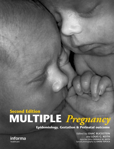 Multiple Pregnancy Epidemiology Gestation And Perinatal Outcome Blickstein