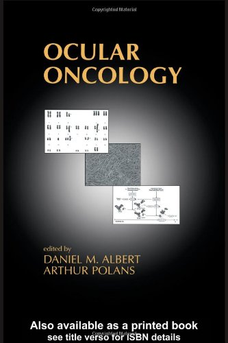 Ocular Oncology 1st Edition Albert Daniel M