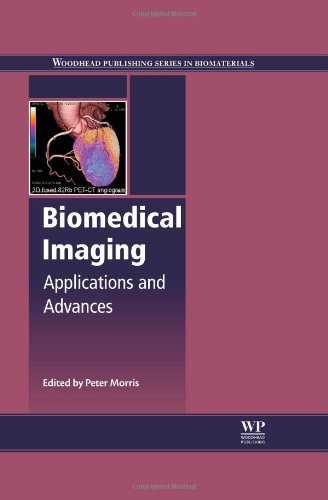 Biomedical Imaging Applications And Advances 1st Edition Peter Morris