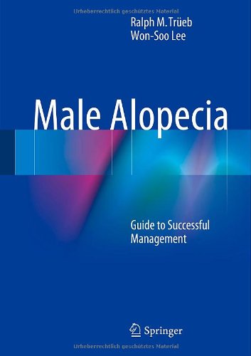 Male Alopecia Guide To Successful Management 2014th Edition Ralph M Treb