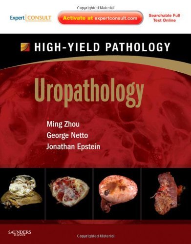 Uropathology A Volume In The High Yield Pathology Series 1 Harpsc Ming Zhou Md Phd