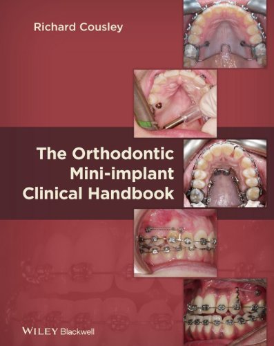 The Orthodontic Miniimplant Clinical Handbook 1st Edition Richard Cousley
