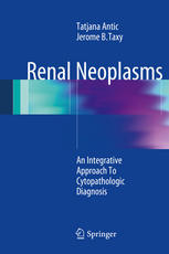 Renal Neoplasms An Integrative Approach To Cytopathologic Diagnosis 1st Edition Tatjana Antic