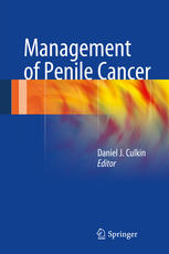 Management Of Penile Cancer 1st Edition Daniel J Culkin Eds