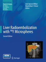 Liver Radioembolization With 90y Microspheres 2nd Edition José Ignacio Bilbao