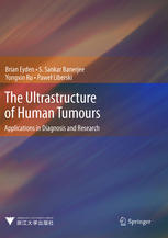 The Ultrastructure Of Human Tumours Applications In Diagnosis And Research 1st Edition Dr Brian Eyden